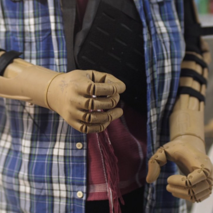 A child fitted with a 3D printed prosthetic arm
